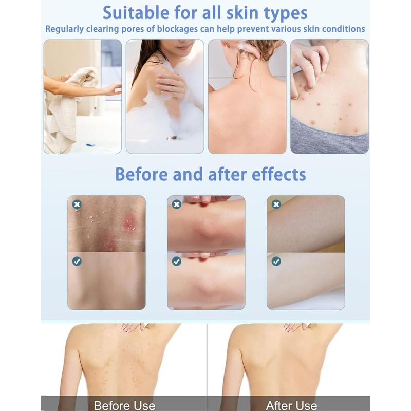 MYGLOAR 4 pezzi di guanti esfolianti coreani, guanti esfolianti per