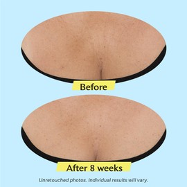 StriVectin TL Advanced™ Tightening Neck Cream Plus, 1.7 oz for Tightening and Firming Neck & Décolleté Lines