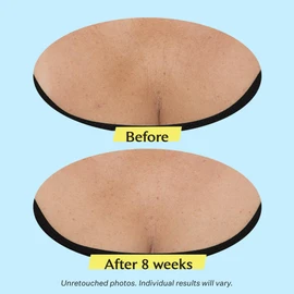 StriVectin TL Advanced™ Tightening Neck Cream Plus, 1.7 oz for Tightening and Firming Neck & Décolleté Lines