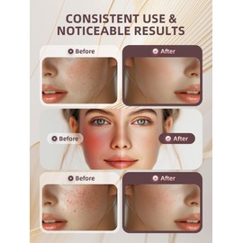 INTEO Multifunctional Facial Massager, Real Glass Glow Device for Face and Neck, Portable Face Massager Tool for Skin Care Pore Care, Enhanced Skin Radiance Effective Against Dullness