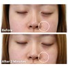 Dermaflage Scar Filler Refill, 4 Applicators