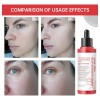 Face Conditioning Aceite Desincrustante Spa Rostro Esencia