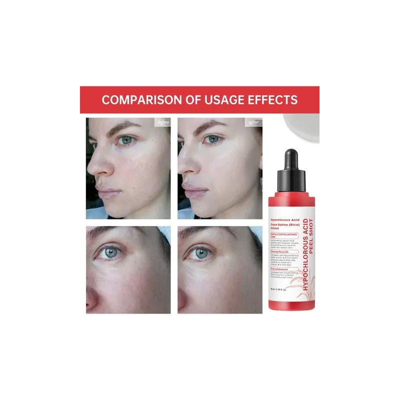Face Conditioning Aceite Desincrustante Spa Rostro Esencia