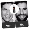OHPHCALL Beard Oil for Men 1 Bottle of Beard Care
