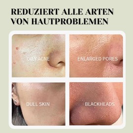 Shefave Grüner Tea Masken, Green Mask Stick, Tiefenreinigung Gesichtsmaske Hautpflege, 2 Stück Mask Stick Blackhead Remover Holzkohle Gesichtsmasken, Kontrolle Öl, Verfeinerung Poren