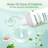 Ultrasonic Retainer Cleaner Solution Concentrate-Professional Cleaning of Retainers, Denture, Invisible