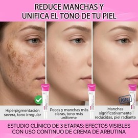3pcs Crema Aclarante Facial con Arbutina 7%, Crema Hidratante para Manchas Oscuras, Pecas y Pigmentación, Unifica el Tono de la Piel, Iluminadora para
