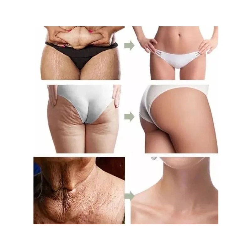 Crema\gel Abdominal P Reducir Abdomen Panza Celulitis Tallas Hierbas