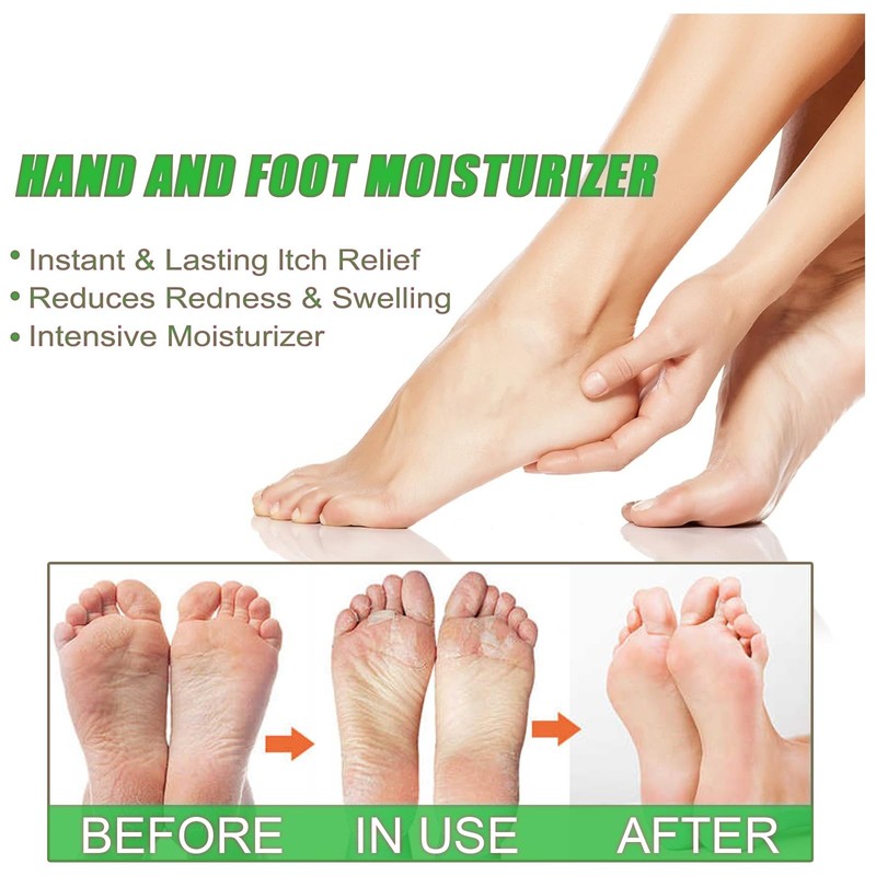 114g Peppermint Foot Cream,Athletes Foot Cream & Cracked Heel Relief,Deep