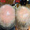 Suplemento Xic Glam Folix Anticada Y Crecimiento De Cabello