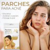 Parches Estrella Anti Acné Mc Life Hidrocoloidal 240 Pza Todo