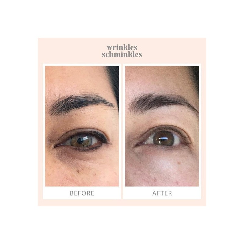Wrinkles Schminkles Eye Wrinkles Patches - 3 Pairs