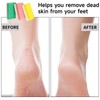 3 Pumice Stones for Feet, Foot Scrubber for Dead Skin