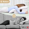 Face Down Pillow After BBL or Eye Surgery with Removable