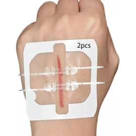 Tiras de Cierre de Heridas de Emergencia Marca Jzuczv 2 unidades