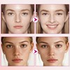 Arbutin 7.0 + TXA 4.0 Cremas Manchas Faciales, Reduce la