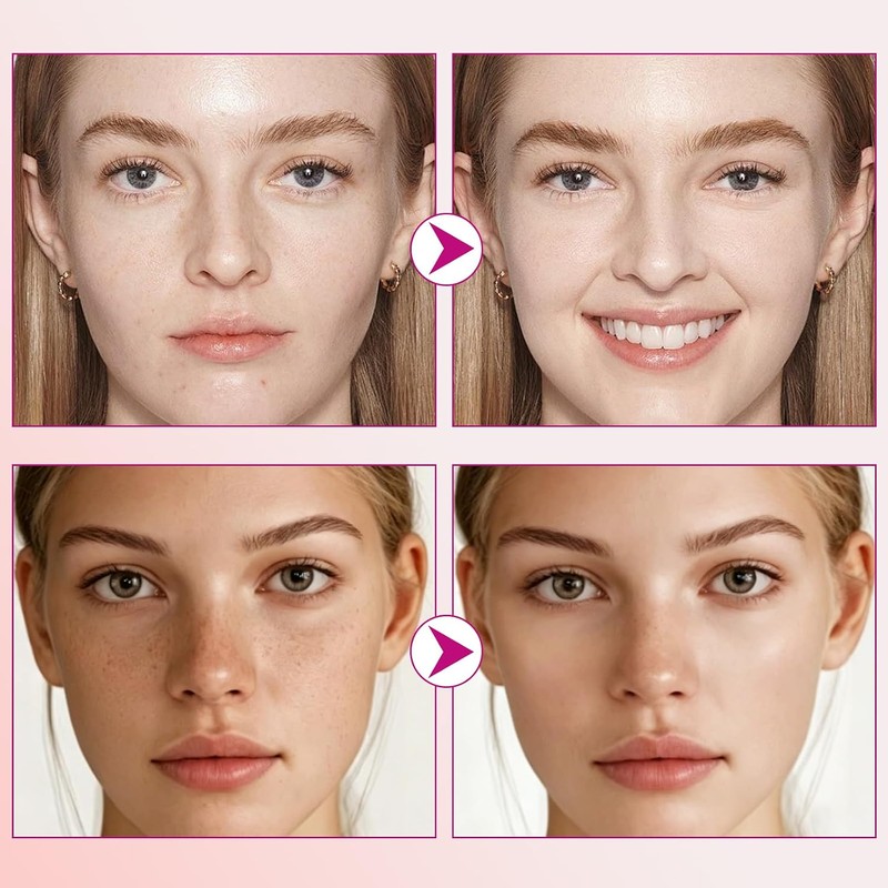 Arbutin 7.0 + TXA 4.0 Cremas Manchas Faciales, Reduce la