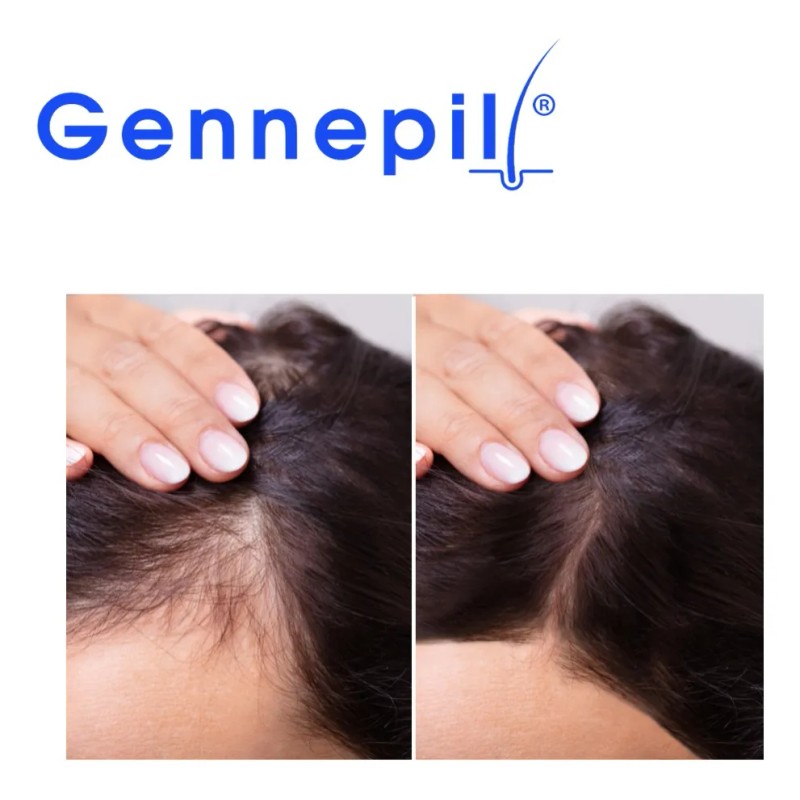 Shampoo Tratamiento Anticaida De Cabello 2 Pzas Gennepil