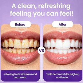 Purple Teeth Whitening Tablets, 2026 New Professional Teeth Restoration Tablets, Alcohol & Peroxide Free, Fresh Mint Flavor, Color Correcting, Alcohol Free Gentle Oral Care (2 Pack)
