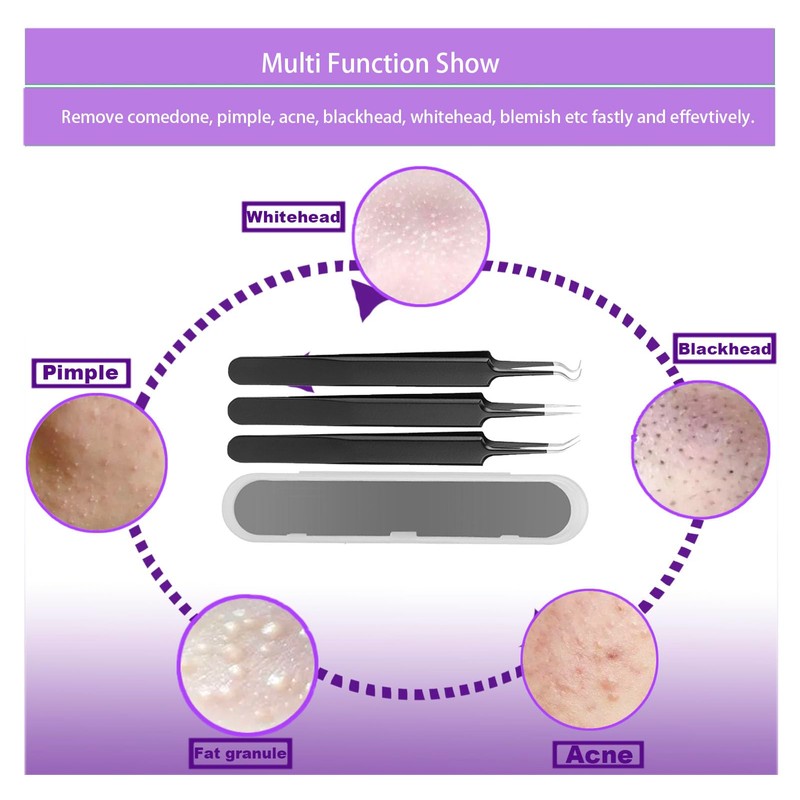 Free Eagle Blackhead Remover Tool Comedones Extractor Acne Removal Kit