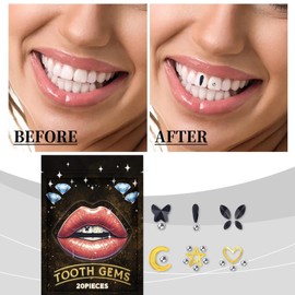 Tooth Gems Crystals - Jewelry Crystal Gem Kit for Tooth Decor - Removable Tooth Ornaments for Teeth Decor, Tooth Gems for Women and Girls