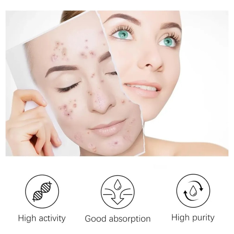 Crema Facial Despigmentante Y Anti Manchas Pack 2 Pzs Todo