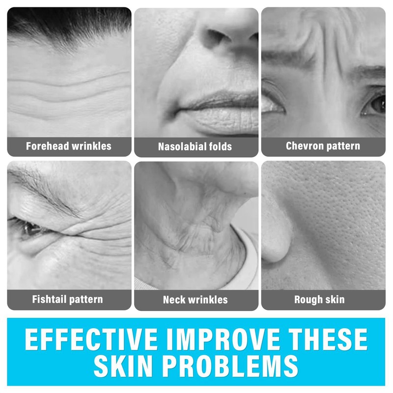 Neck Face Beauty Device Anti Aging Wrinkle Removal 4 Modes