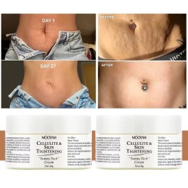 Mooyam 2 Cellulite & Skin Tightening "Tummy Tuck” Cream Elasticity Belly Stretch Mark
