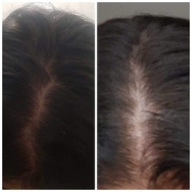 By Nu Skin Nutriol Shampoo