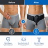 Inguinal Hernia Support Belt for Daily Comfort – Adjustable Groin