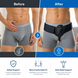Inguinal Hernia Support Belt for Daily Comfort – Adjustable Groin Truss with Removable Compression Pad