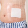 Waterproof Wound Bandage Patches with Absorbent Gauze Pads, Large Wound