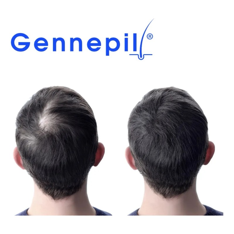 Shampoo Tratamiento Anticaida De Cabello 2 Pzas Gennepil