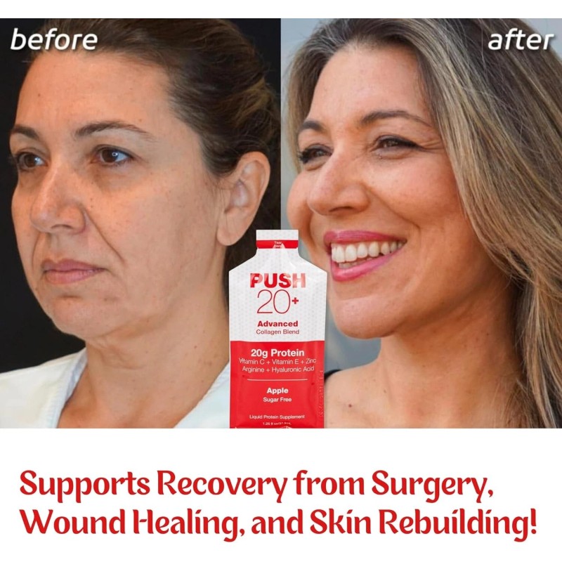 Liquacel PUSH20+ Liquid Collagen Protein Shot – 20g Pack of