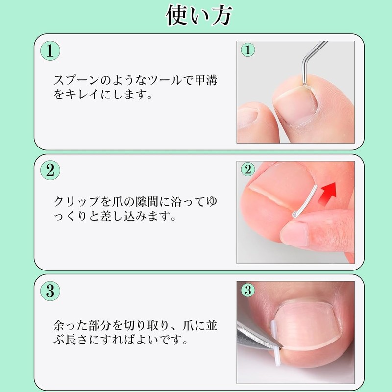 Chisafly Rolling Nail Clips, Rolling Toenails, Foot Coiled Toenails [10