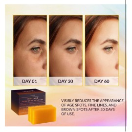 VALITIC Kojic Acid Dark Spot Remover Soap Bars Vitamin C Retinol Collagen Tumeri