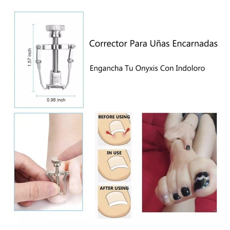 Lenio® Uñas Encarnadas Juego De Pedicura Acero Inoxidable