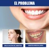 Retenedor De Dientes Para Corrección De Sonrisa. Dispositivo de Ortodoncia
