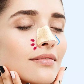 DH Trading 리프팅 콧대 관리 기구 콧볼 코 패치 미용 성형 Lifting Nose Bridge Care Device Nose Wing Patch Beauty Plastic Surgery [5 pieces per set]