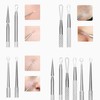 Acne Needle Black Remove Acne Pores Care Exclusive Kit Getting