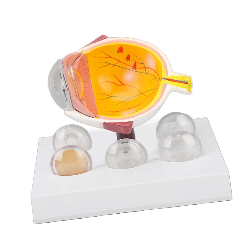 Enlarged Human Eye Anatomical Model Accurate Shows Optic Nerves Cornea