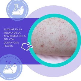 Crema a base de urea concentrada al 5% y ácido láctico concentrado al 5% 200 gramos.