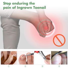 BEZOX Professional Ingrown Toenails Toenails Toenail Tool, 2 Pieces, Corner Lifter and Nail File, Double-Sided Corner Lifter, Foot Care, Stainless Steel Manicure & Pedicure Nail Care Set