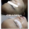 CELLOFILL REJUVE 3ml Vial | Korean Glow Booster for Skin