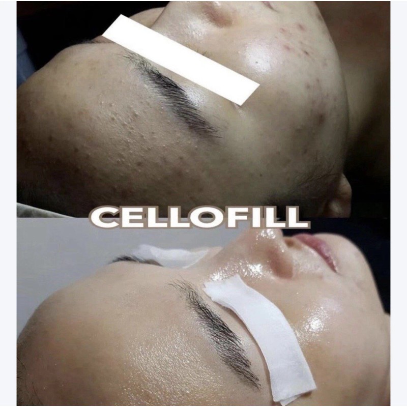 CELLOFILL REJUVE 3ml Vial | Korean Glow Booster for Skin