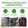 Some By Mi - Cica Peptide Anti Hair Loss Derma