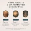 Head Hair Serum For Men & Women With Procapil Biotin,