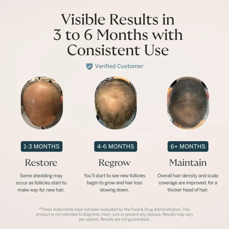 Head Hair Serum For Men & Women With Procapil Biotin,