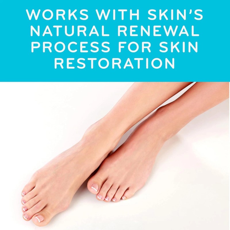 AmLactin Foot Repair Cream 15% Lactic Acid 3oz for Dry