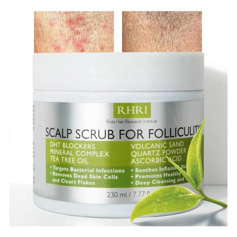 Exfoliante Antifúngico Cuero Cabelludo Sensible 230 Ml